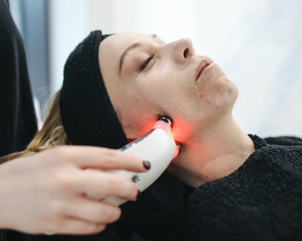 woman-receiving-laser-hair-removal-on-face